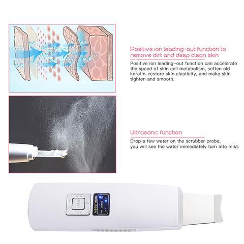 Ultrasonic Skin Scrubber – Deep Facial Cleansing Tool
