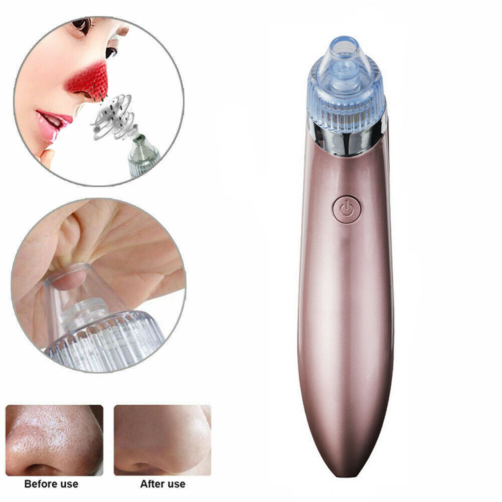 Electric Blackhead Remover – Pore Vacuum & Face Cleanser