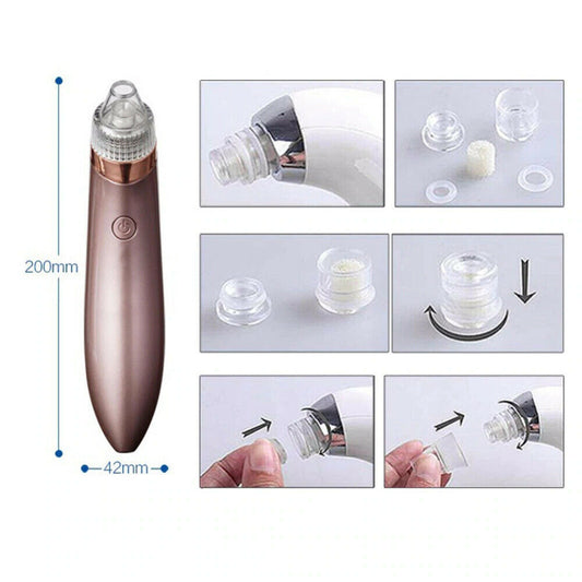 Electric Blackhead Remover – Pore Vacuum & Face Cleanser