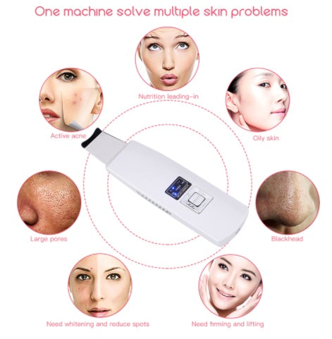Ultrasonic Skin Scrubber – Deep Facial Cleansing Tool