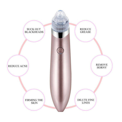 Electric Blackhead Remover – Pore Vacuum & Face Cleanser