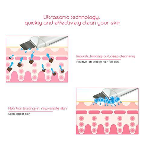 Ultrasonic Skin Scrubber – Deep Facial Cleansing Tool