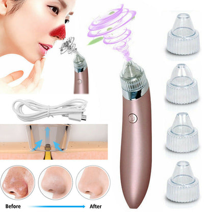 Electric Blackhead Remover – Pore Vacuum & Face Cleanser