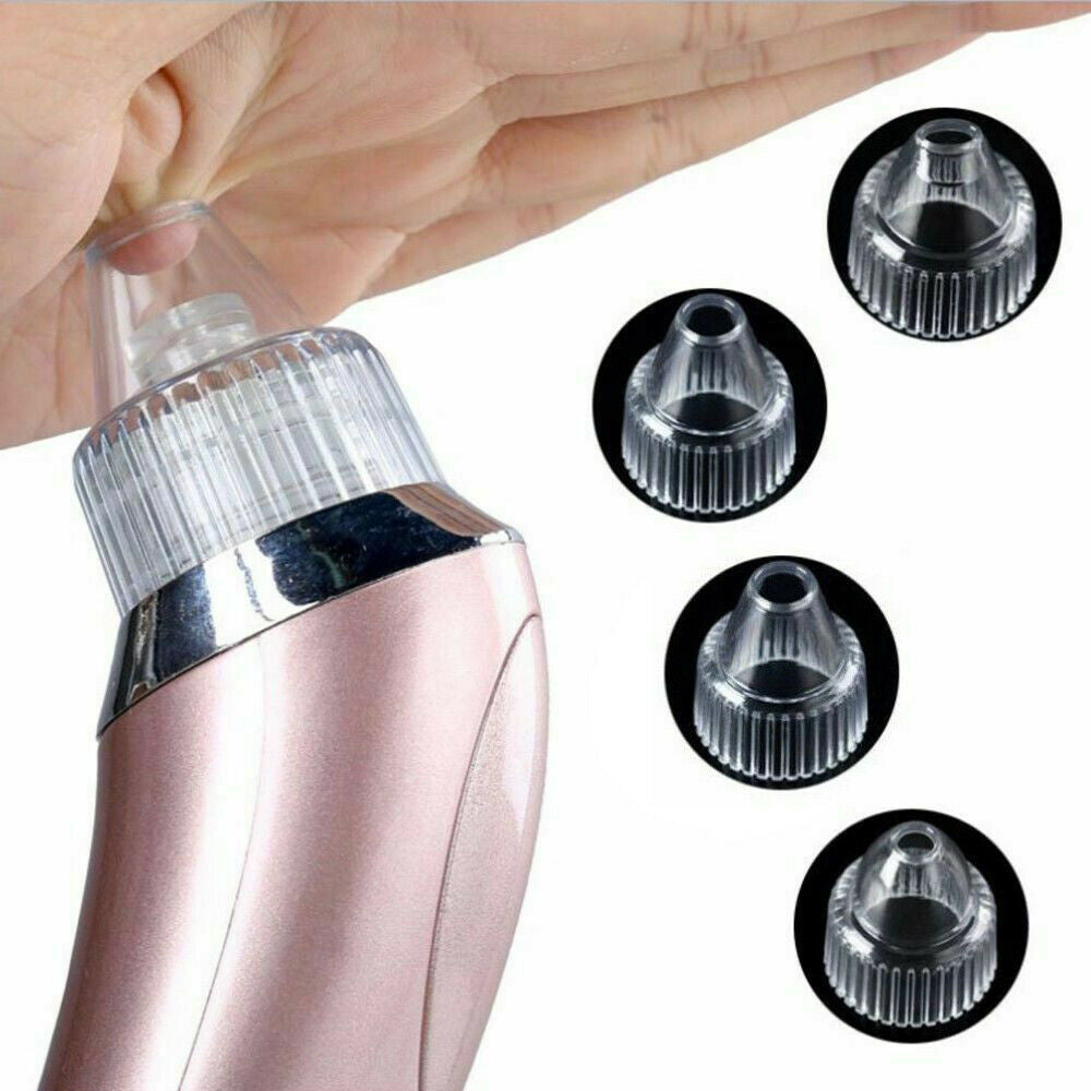 Electric Blackhead Remover – Pore Vacuum & Face Cleanser