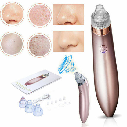 Electric Blackhead Remover – Pore Vacuum & Face Cleanser